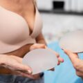 Podniesienie piersi z implantem czy bez – jak podjąć decyzję, żeby nie żałować po roku?